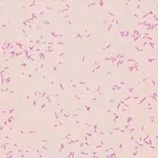 Yersinia Enterocolitica Antigen, Stool